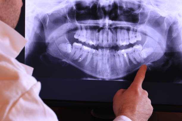 Best Urgent Care for Lost Fillings or Crowns in Fort Gibson, OK