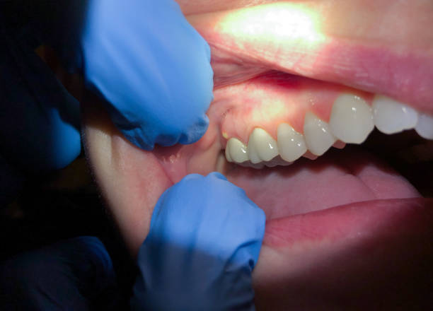 Best After-Hours Dental Trauma Care in Fort Gibson, OK