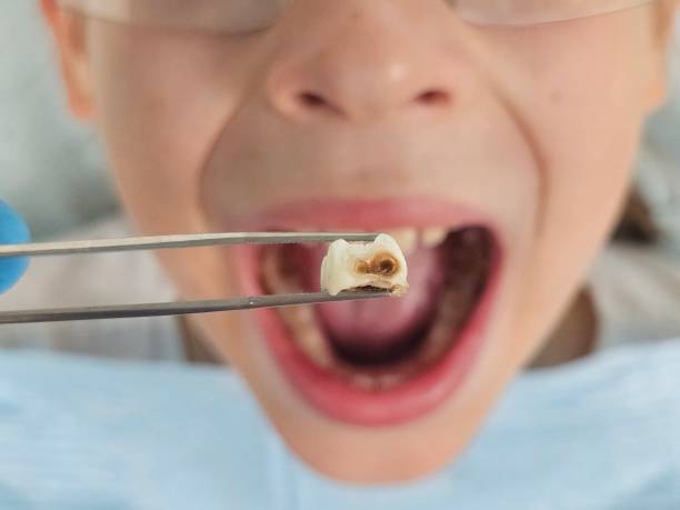Best Pediatric Emergency Dentist in Fort Gibson, OK